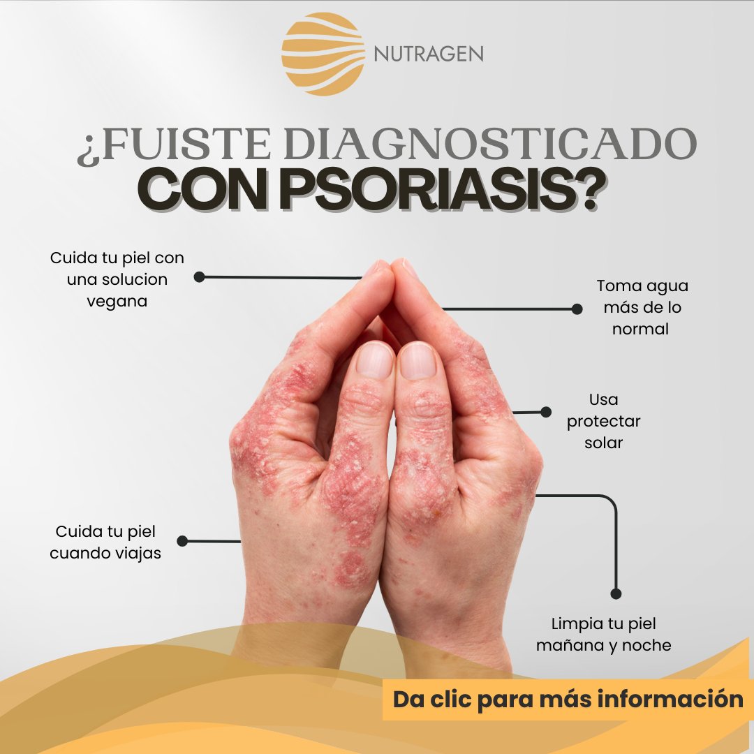 Nutragen — Psoriasis Manos