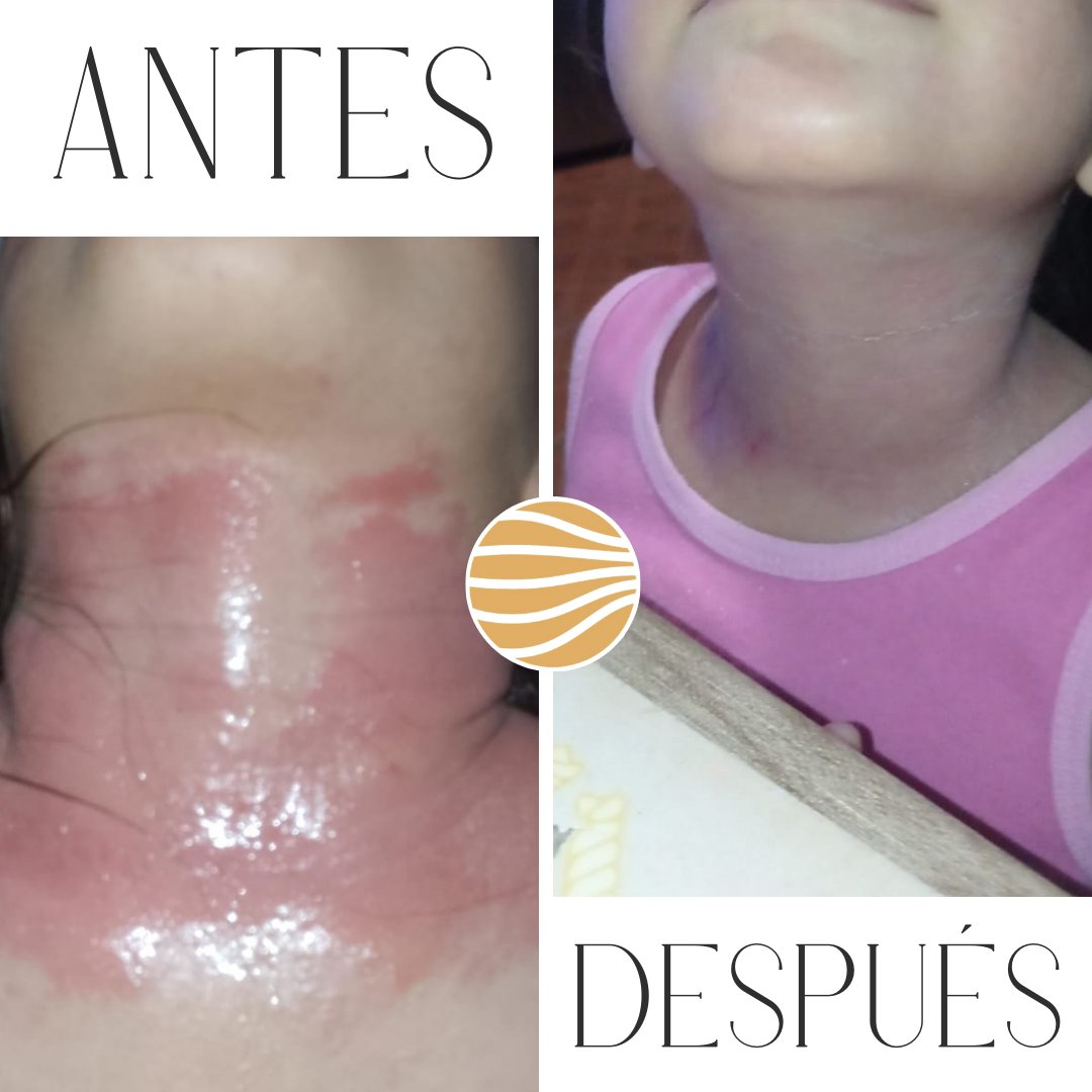 Antes y Después — Cuello