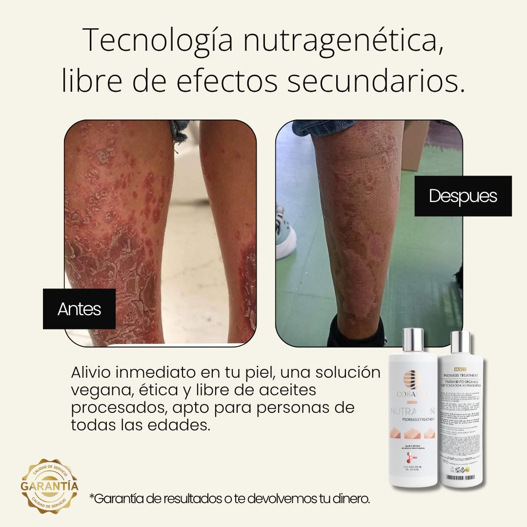 Antes y Después — Nutragen Piernas