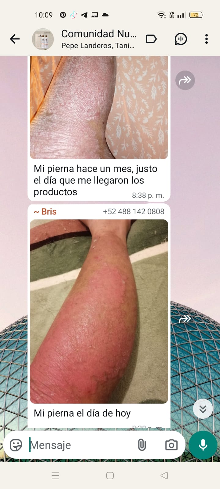 Testimonio Bris — Nutragen Comunidad